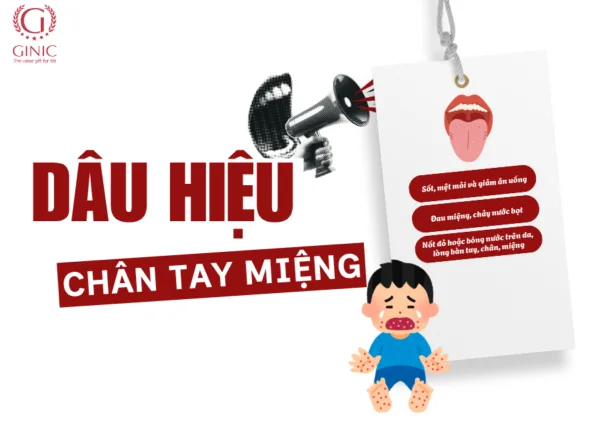 DẤU HIỆU NHẬN BIẾT SỚM KHI TRẺ MẮC CHÂN TAY MIỆNG